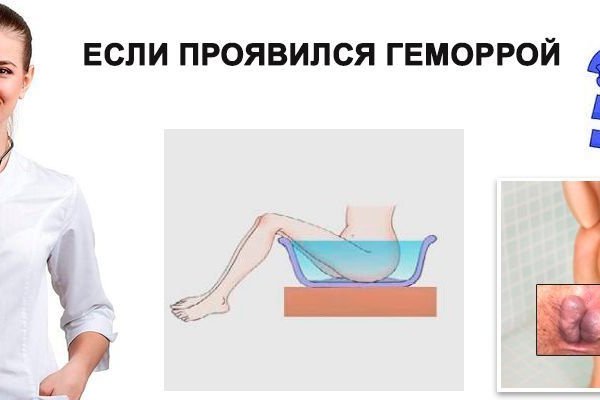 Что продают в кракен маркете